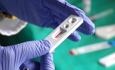 Скільки пацієнтів з діагнозом «ВІЛ-інфекція» перебуває під наглядом у Жовтих Водах