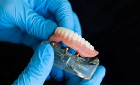 У 2024 році стартує пілотний проєкт з безоплатного зубопротезування ветеранів