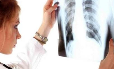 Туберкульоз: навіщо потрібна проба Манту і що робити у разі інфікування