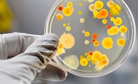 Сальмонельоз: про захворюваність на Старокостянтинівщині та поради від лікаря як вберегтися