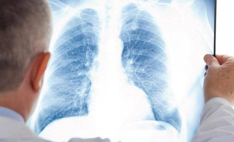 Для ВПО з Луганщини в гумхабі працюватиме пересувний флюорограф. Потрібно попередньо записатися