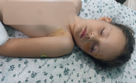 Перевернувся батут, 7-річна дівчинка травмована, матір просить про підтримку