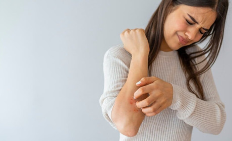 Нафталанові креми та мазі від псоріазу у Києві та Україні з доставкою