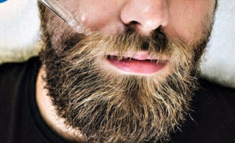 Історія Minoxidil: як він став лідером на ринку засобів для росту волосся