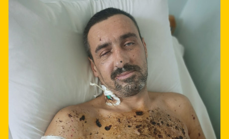 Важко поранений військовий із Первомайська: родина просить підтримки