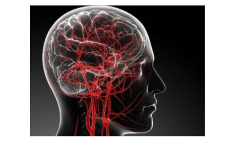 Невидимий ворог: причини та лікування порушення мозкового кровообігу
