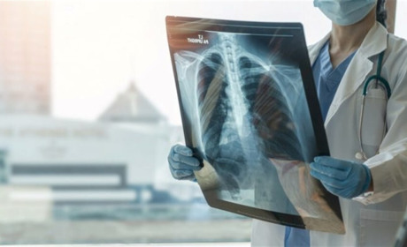 У Жовтих Водах зростає кількість хворих на туберкульоз