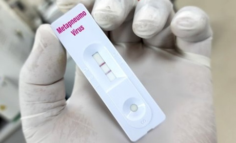 На Одещині зафіксовано сім випадків метапневмовірусу: що треба знати