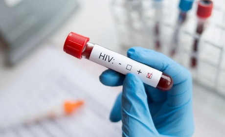 У Мелітополі стрімко зростає кількість ВІЛ-інфікованих через присутність необстежених військових рф