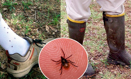 Як убезпечити себе та рідних від кліщів: природні засоби та корисні поради