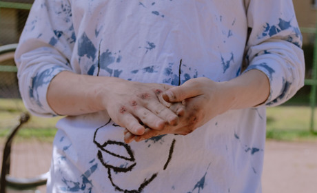 У Гадячі 16-річний хлопець постражав від хуліганських дій інших підлітків