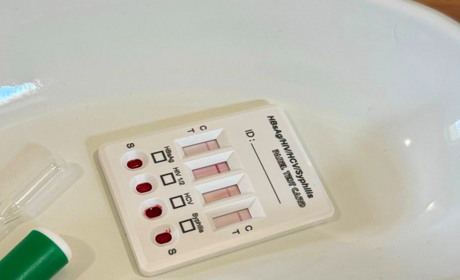 Жителі Південного можуть анонімно та безкоштовно пройти тестування на ВІЛ