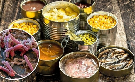 В Одеській області з початку року зафіксували три випадки ботулізму