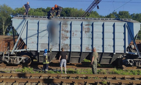 Як почуває себе дівчина з Ніжина, яка зазнала ураження електрострумом на даху потяга?