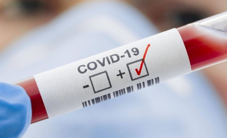 На Полтавщині внаслідок COVID-19 померли двоє людей