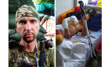 Від передової на Донеччині до лікарняних палат: історія Захисника з Фастова Олександра Редька