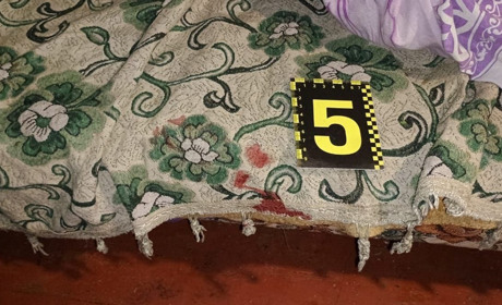 У Сарненському районі син вдарив батька кухонним ножем