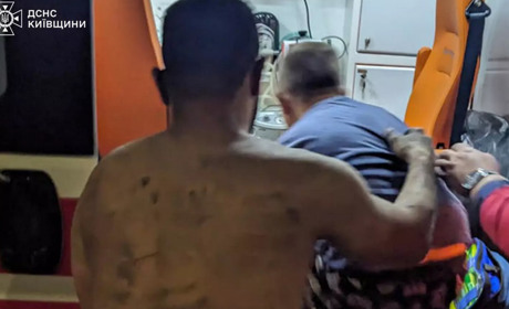 На Фастівщині вибух зарядного пристрою спричинив пожежу в багатоповерхівці