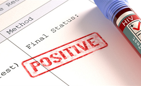 На Полтавщині зростає кількість людей з ВІЛ: що важливо знати