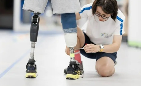 MCOP в Україні: де та як військові можуть пройти протезування