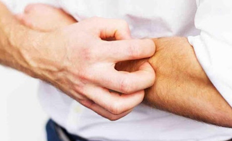 Що таке короста: симптоми, причини та ризики