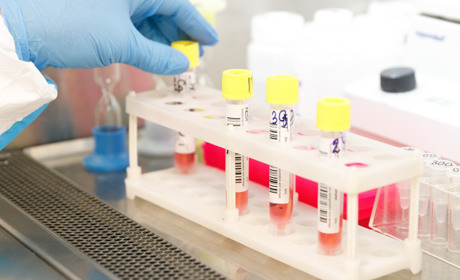 Після свят на Полтавщині зафіксували зниження рівня інфекційних захворювань