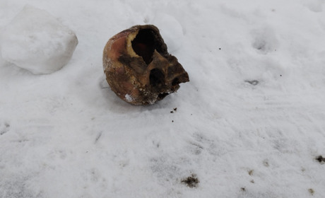 У Глухові на узбіччі дороги знайшли людські рештки: поліція з’ясовує обставини