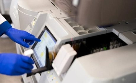 Печінкові проби: які аналізи входять, як підготуватися і як читати результати