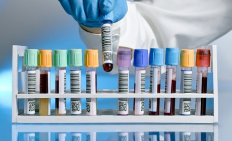 ТОП-10 лабораторних пробірок для медичних і дослідницьких лабораторій