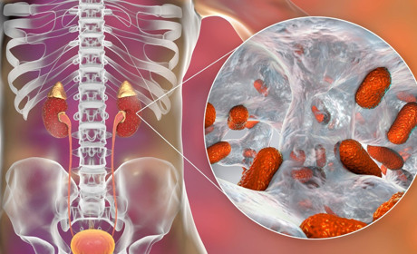 Топ-10 фруктів, корисних для нирок при пієлонефриті