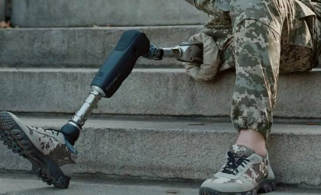 Як отримати безоплатний протез: інструкція для військових і цивільних