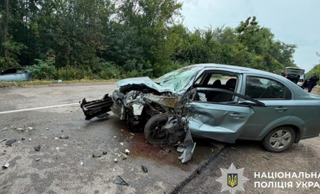 Смертельна ДТП на Фастівщині: 72-річна пасажирка померла в лікарні