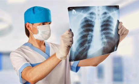 Лікар зі Сватового відповідає на 10 запитань про туберкульоз: чим небезпечна ця хвороба