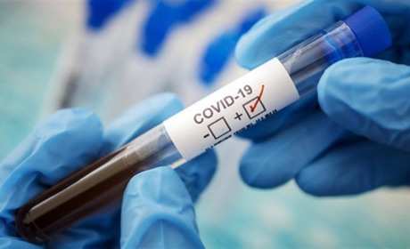 У Южному 56 осіб захворіло на Covid-19 за останню добу