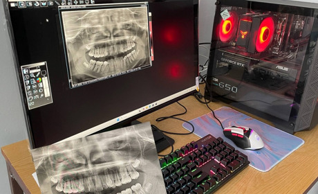 Цифрова стоматологія у Нетішині: сучасна 3D-діагностика та безкоштовні обстеження для військових