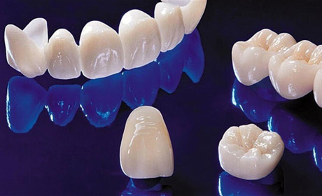 Металокерамічна коронка: бюджетне рішення з естетичним виглядом