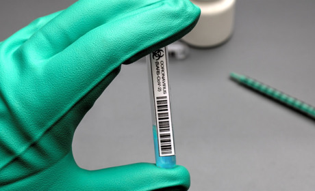 У Сватівському районі COVID-19 підтвердили у 15 людей, один хворий помер: яка ситуація на Луганщині