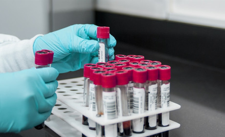 Кількість хворих на COVID-19 в Україні зростає. Яка ситуація на Луганщині і у Сватівському районі