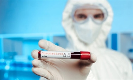 Почім тести для народу