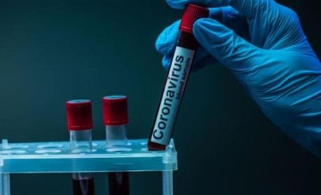 Серед хворих на коронавірус золотонісців одна із жінок інфікувалася вдруге
