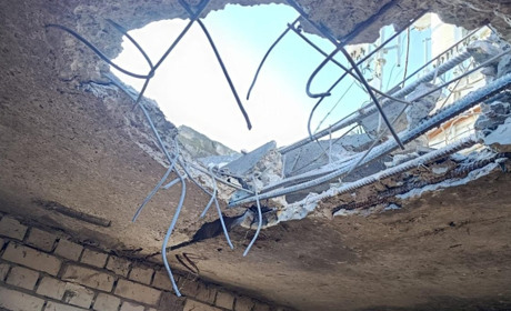 Окупанти атакували центр Херсона: жінці відірвало ногу, вона у тяжкому стані