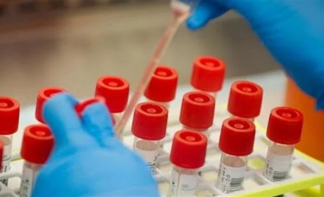 У Кагарлицькому районі протягом вихідних виявили ще два випадки коронавірусу