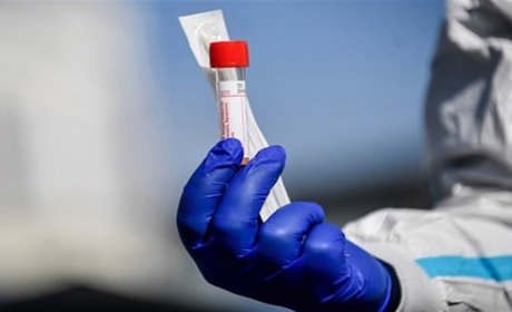 670 інфікованих, з них 155 дітей