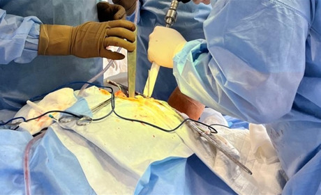 Складні операції на суглобах – тепер у серці Полтавщини, в місті Гадяч