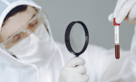 У Сватівському районі за три доби COVID-19 підтвердили у 13 мешканців району: яка ситуація у області