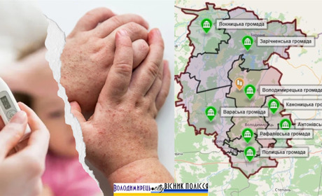Статистика по скарлатині у Вараському районі зростає