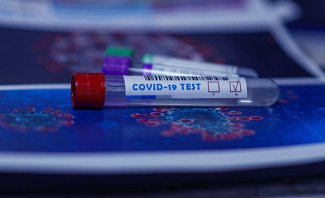 Тижнева статистика: у Золотоноші зафіксовано 107 хворих на COVID-19, на Золотоніщині – майже 300