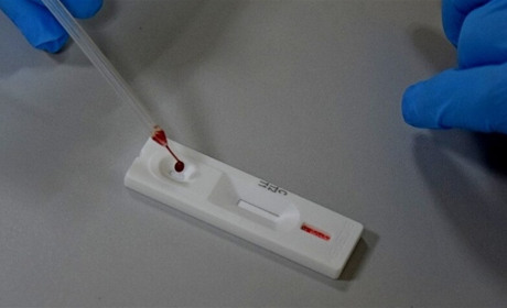 Виявляють COVID і грип: українські вчені розробили нові ПЛР-тести