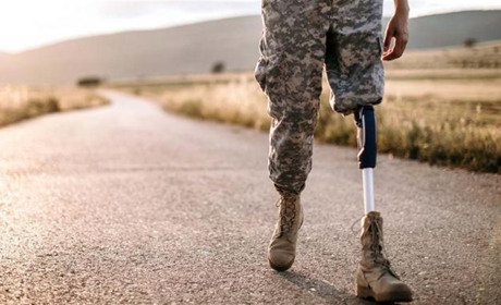 Українські військові зможуть отримати протез і розпочати реабілітацію до встановлення інвалідності