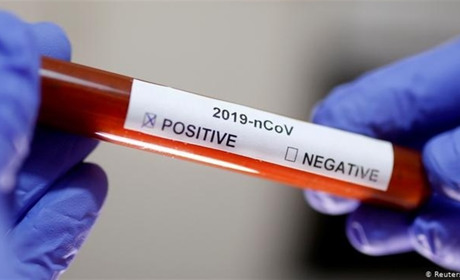 Коронавірус на Луганщині: яка ситуація з поширенням COVID-19 у області на 25 вересня 2021